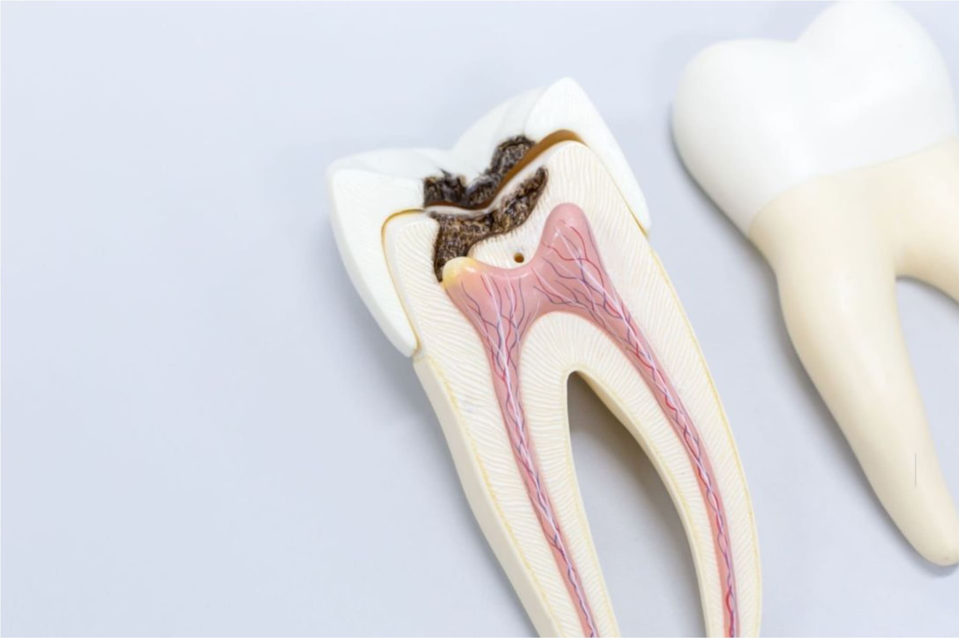 Canal de Dente